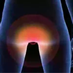 Anal Cancer TaazaDaily365