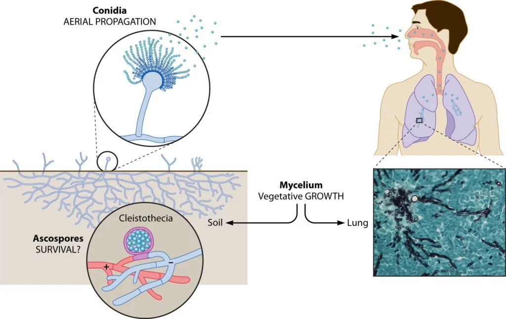 Aspergillus Fumigatus Chart TaazaDaily365 Health