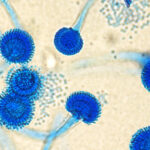 Aspergillus Fumigatus WHO Warning TaazaDaily365 Health