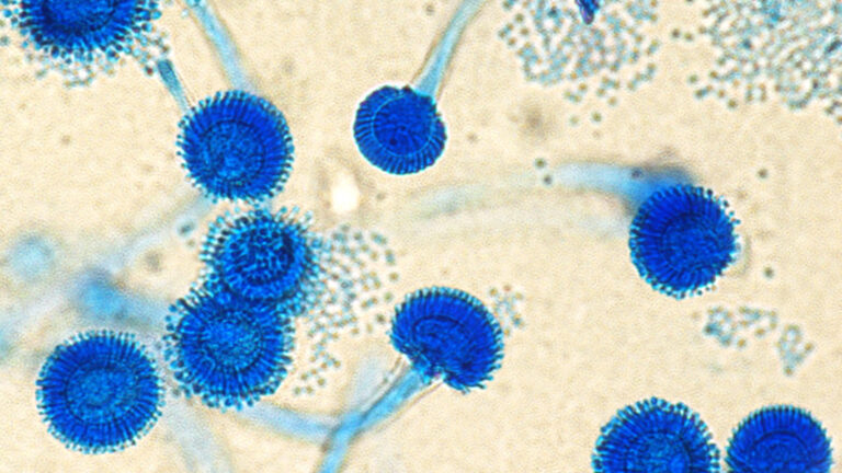 Fungi That Could ‘Eat You from Inside Out’ Likely to Spread Amid Warming Planet