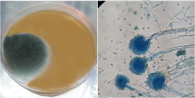 Aspergillus-fumigatus-on-PDA-culture-and-slide TaazaDaily365 Health