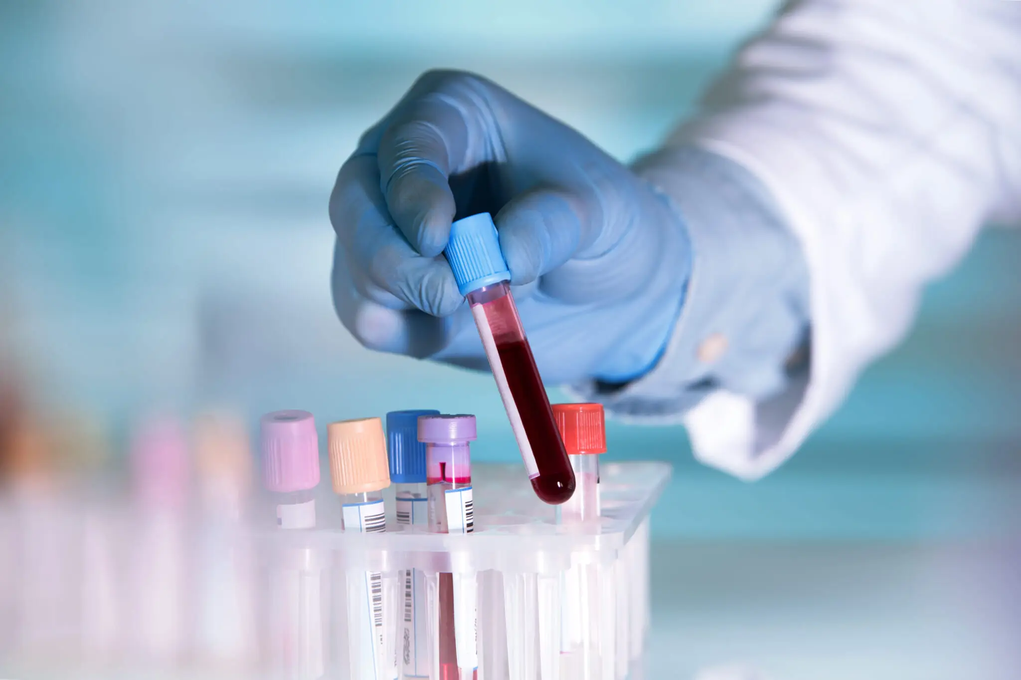 Artificial Blood Developed By Japan TaazaDaily365 Health